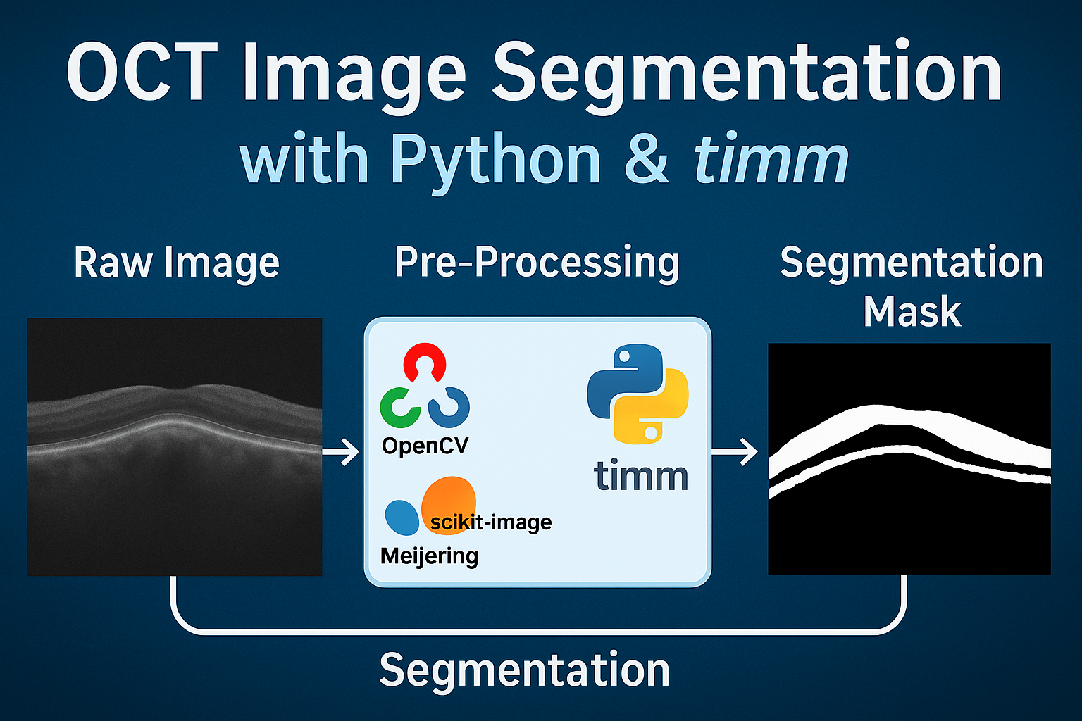 OCT Image Segmentation Project